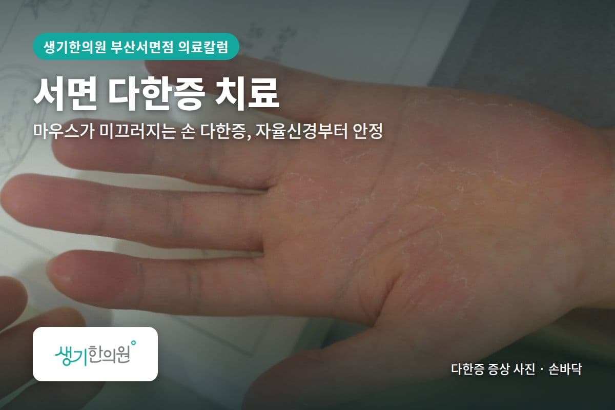 손바닥 다한증 증상 사진과 문구 「서면 다한증 치료, 마우스가 미끄러지는 손 다한증, 자율신경부터 안정 · 생기한의원 부산서면점」